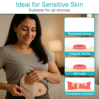 Ostomy Adhesive Barrier Ring